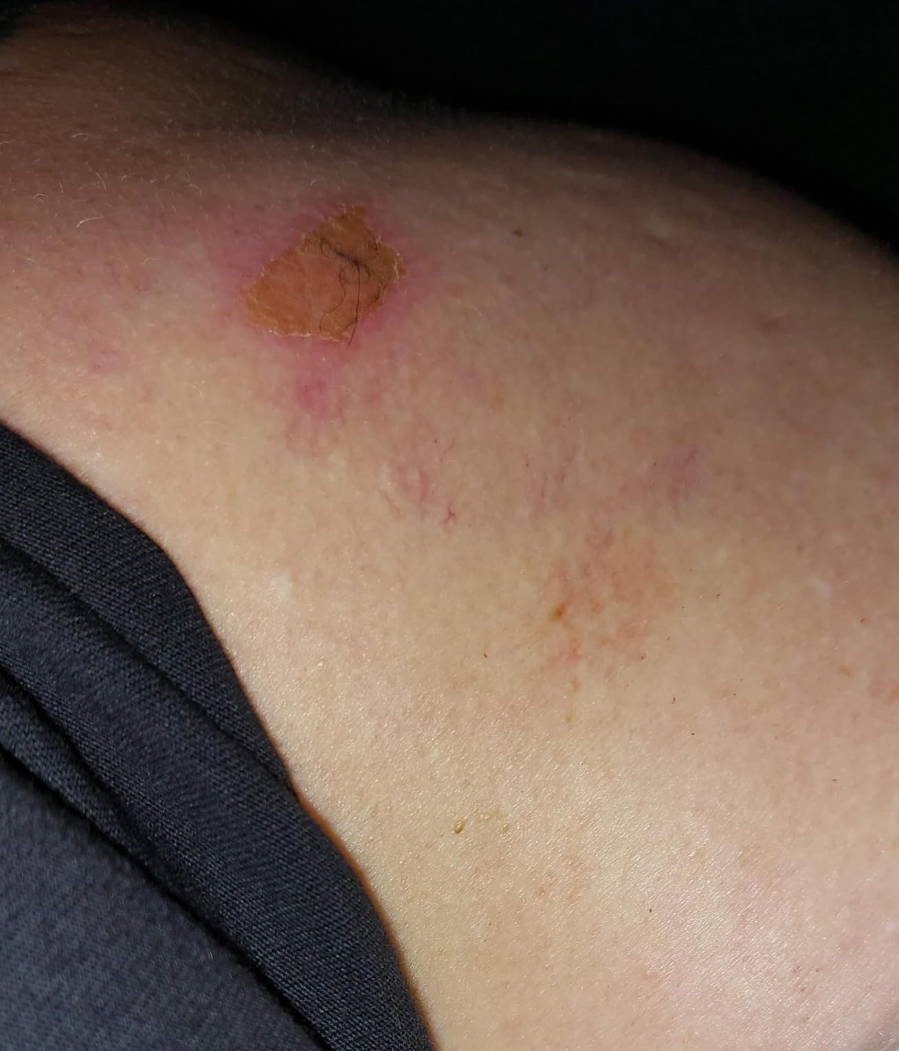 Tiefenmassage wie beim Profi